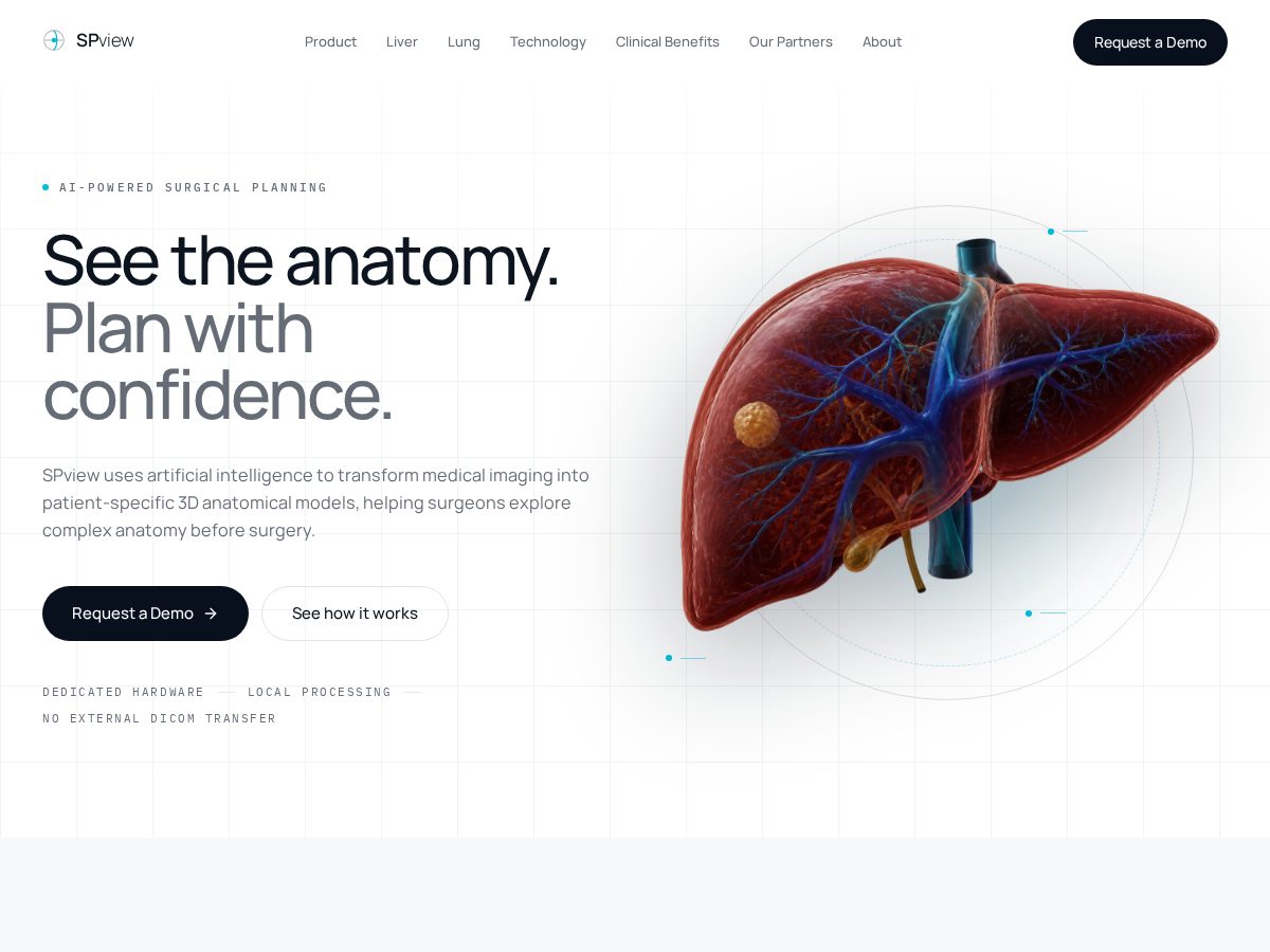 Landing-page snapshot of spview.tech