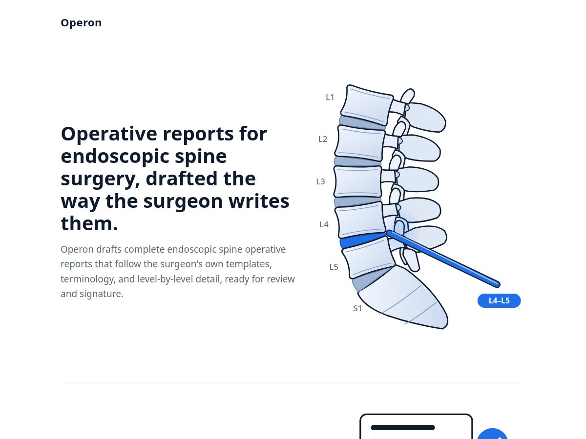 Landing-page snapshot of operonspine.com