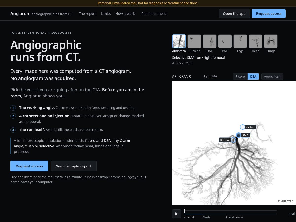 Landing-page snapshot of angiorun.com
