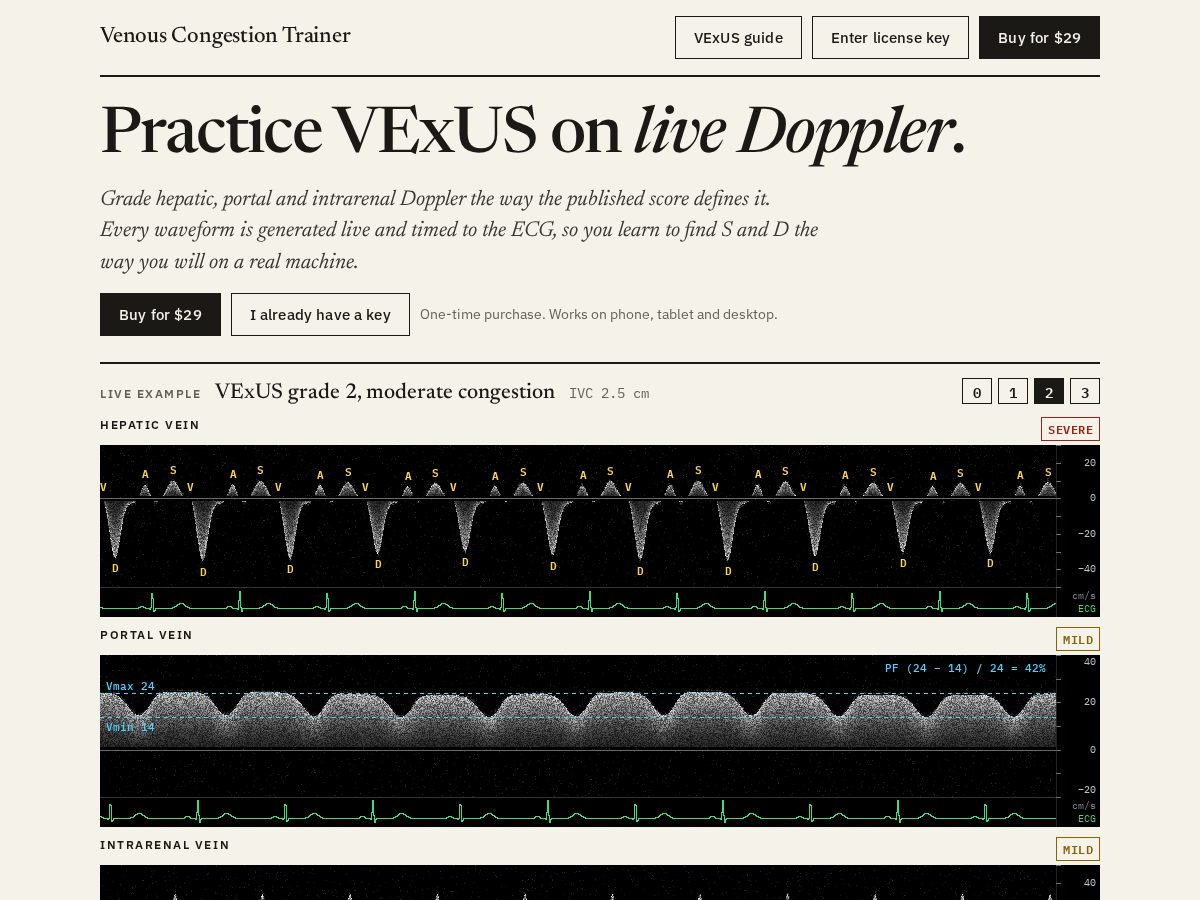 Landing-page snapshot of venouscongestiontrainer.com