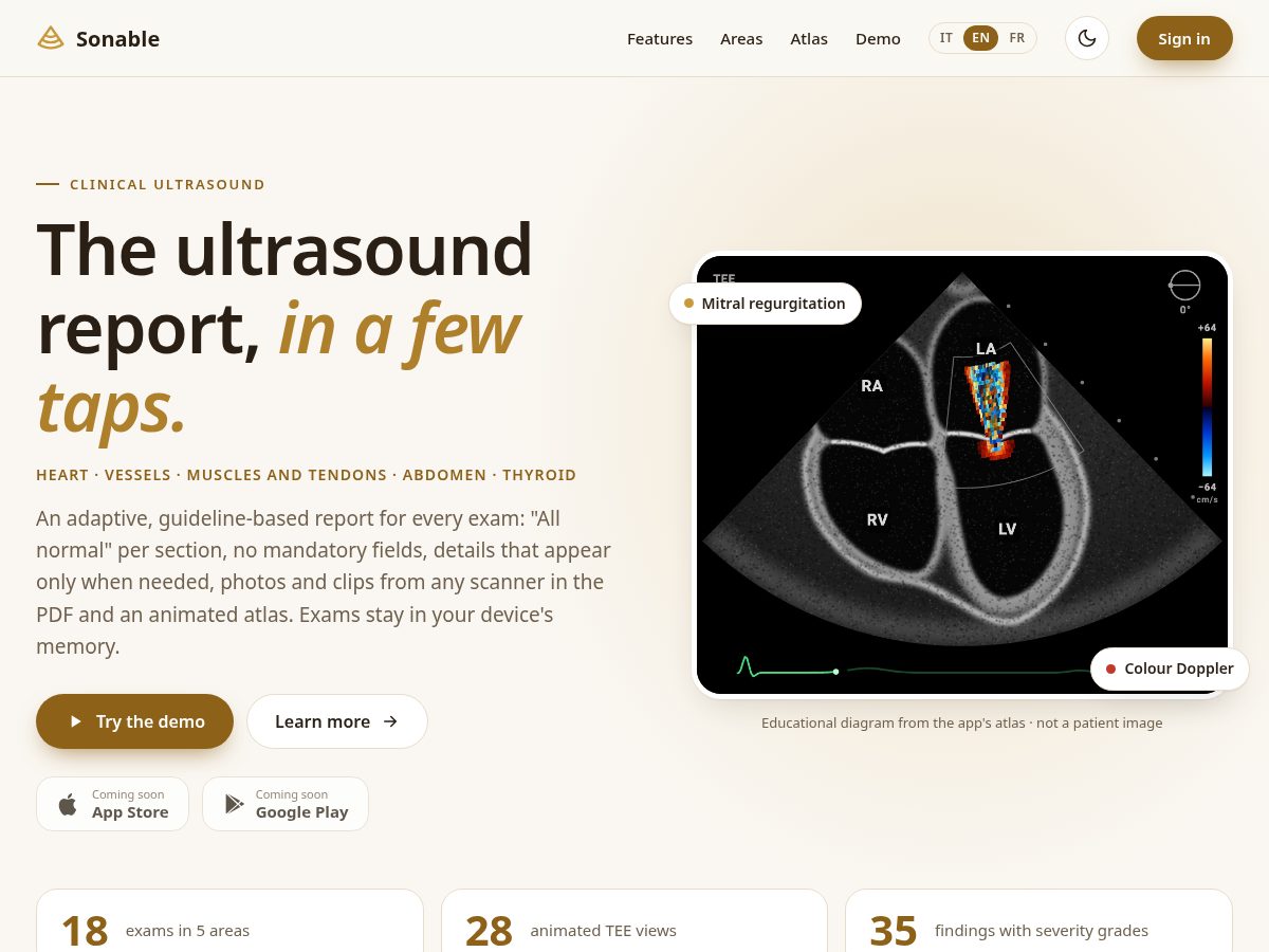 Landing-page snapshot of sonable.app