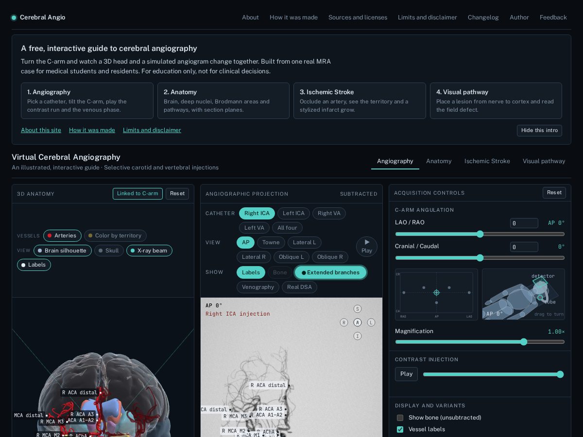 Landing-page snapshot of cerebralangio.com
